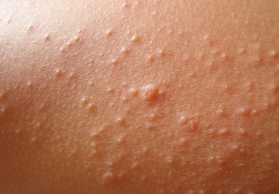 causes skin rashes that itch causes skin rashes that itch