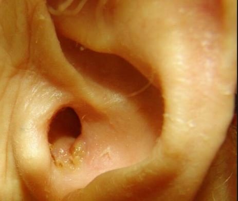 my right ear itch deep inside my right ear itch deep inside
